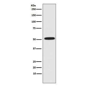 ERG Antibody HeLa WB. Western blot testing of human HeLa cell lysate with ERG antibody. Predicted molecular weight ~54 kDa.