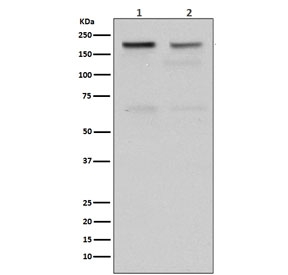 Topoisomerase II alpha Antibody for WB / TOP2A Western Blot Antibody (clone FB-20). Western blot analysis of human cell lysates using recombinant rabbit monoclonal clone FB-20 demonstrates detection of TOP2A protein following SDS-PAGE separation and membrane transfer. Lane 1: HeLa cell lysate. Lane 2: Jurkat cell lysate. A band is detected at approximately 170-180 kDa, consistent with the predicted molecular weight of Topoisomerase II alpha / TOP2A (~174 kDa). The clear band observed in both lysates confirms recognition of denatured TOP2A protein in western blot assays and supports the use of this antibody for western blot detection of TOP2A expression in human cell lines.