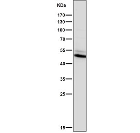 Western blot testing of human Saos-2 cell lysate with Vitamin D Receptor antibody. Predicted molecular weight 48/54 kDa (isoforms 1/2).