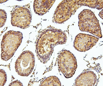 IHC staining of FFPE rat testis tissue with PEF1 antibody. HIER: boil tissue sections in pH8 EDTA for 20 min and allow to cool before testing.
