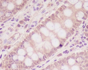 IHC staining of FFPE human colon with M6PR antibody. HIER: boil tissue sections in pH6, 10mM citrate buffer, for 10-20 min and allow to cool before testing.