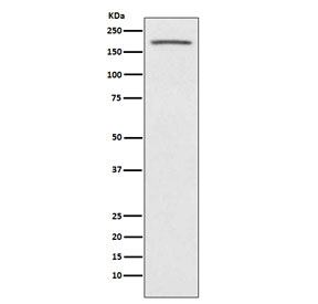 ACE Antibody Human Fetal Kidney WB. Western blot testing of human fetal kidney lysate with ACE antibody. Predicted molecular weight: 140-170 kDa.