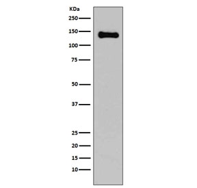 Western blot testing of rat C6 cell lysate with E-Cadherin antibody. Expected molecular weight: 135 kDa (precursor), 80-120 kDa (mature, depending on glycosylation level).