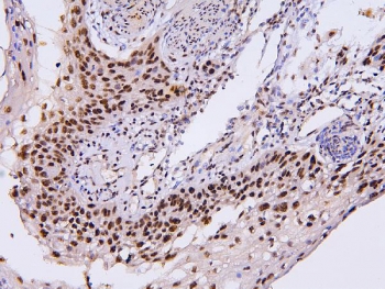 IHC staining of FFPE human esophagus squama with BHC80 antibody. HIER: boil tissue sections in pH6, 10mM citrate buffer, for 20 min and allow to cool before testing.