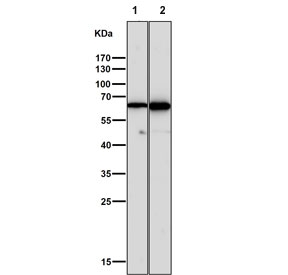 Western blot testing of 1) mouse kidney and 2) rat heart tissue lysate with Keratin 5 antibody. Predicted molecular weight: 58-62 kDa.