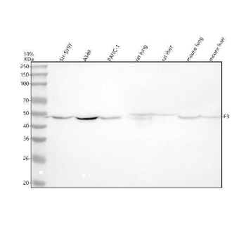 Tissue Factor Antibody Multi-Species WB. Western blot analysis of human, rat, and mouse lysates using Tissue Factor antibody. Lane 1: human SH-SY5Y lysate, Lane 2: human A549 lysate, Lane 3: human PANC-1 lysate, Lane 4: rat lung lysate, Lane 5: rat liver lysate, Lane 6: mouse lung lysate, Lane 7: mouse liver lysate. A predominant band is detected near 45-50 kDa, compared to the predicted molecular weight of Tissue Factor / F3 / CD142 at approximately 35 kDa. The higher apparent molecular weight is consistent with known glycosylation of this membrane-associated coagulation receptor, which can alter electrophoretic mobility during SDS-PAGE analysis. The observed expression pattern supports the role of Tissue Factor in coagulation pathway activation, inflammatory signaling, vascular injury response, and tumor-associated procoagulant activity across multiple mammalian tissues and cell types.