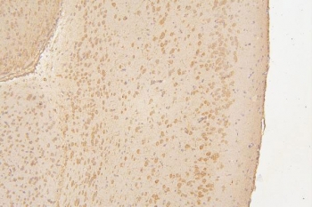 IHC staining of FFPE mouse brain with Semaphorin 3B antibody. HIER: boil tissue sections in pH8 EDTA for 20 min and allow to cool before testing.