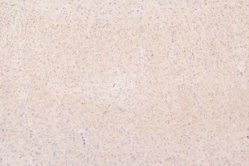 IHC staining of FFPE rat brain with Semaphorin 3B antibody. HIER: boil tissue sections in pH8 EDTA for 20 min and allow to cool before testing.