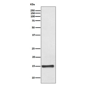 FABP4 Antibody Fetal Heart WB. Western blot testing of human fetal heart lysate with FABP4 antibody. Predicted molecular weight ~15 kDa.