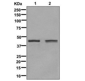Western blot testing of human 1) Jurkat and 2) HeLa cell lysate with Glutamine Synthetase antibody for WB. Predicted molecular weight ~42 kDa.