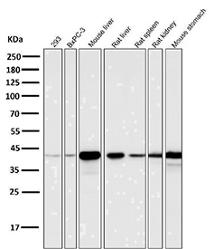Western blot analysis of Glutamine Synthetase Antibody for WB CCH-7 in multiple cell and tissue lysates. Lane 1: 293 cells, Lane 2: BxPC-3 cells, Lane 3: mouse liver, Lane 4: rat liver, Lane 5: rat spleen, Lane 6: rat kidney, Lane 7: mouse stomach. A band is detected at approximately 42 kDa, consistent with the predicted molecular weight of Glutamate-ammonia ligase (GLUL). Strong signal is observed in liver samples, aligning with the known pericentral hepatocyte enrichment of glutamine synthetase, while lower intensity bands are present in non-hepatic tissues. The antibody was used at a 1:5,000 dilution for 1 hour at room temperature.