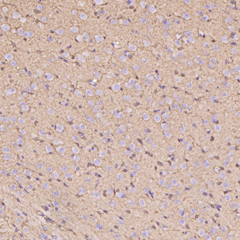 Immunohistochemistry of Glutamine Synthetase Antibody in rat cerebral cortex. Formalin-fixed, paraffin-embedded rat cortex demonstrates diffuse cytoplasmic HRP-DAB brown staining in astrocytic cells distributed throughout the neuropil, consistent with Glutamate-ammonia ligase (GLUL) localization in glial populations. Neuronal cell bodies show comparatively weaker staining, while background is minimal. The antibody was applied at a 1:400 dilution for paraffin-embedded tissue analysis.