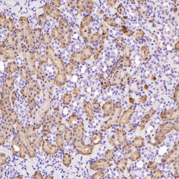 Immunohistochemistry of Glutamine Synthetase Antibody in rat kidney. Formalin-fixed, paraffin-embedded rat kidney tissue demonstrates cytoplasmic HRP-DAB brown staining in renal tubular epithelial cells, consistent with Glutamate-ammonia ligase (GLUL) expression in metabolically active nephron segments. Glomerular structures show comparatively lower staining intensity. The antibody was applied at a 1:400 dilution for paraffin-embedded tissue analysis.