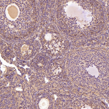 Immunohistochemistry of Glutamine Synthetase Antibody in mouse ovary. Formalin-fixed, paraffin-embedded mouse ovarian tissue demonstrates cytoplasmic HRP-DAB brown staining in granulosa cells and stromal cell populations, consistent with Glutamate-ammonia ligase (GLUL) localization in metabolically active ovarian compartments. Oocyte nuclei remain unstained, while surrounding follicular cells show diffuse cytoplasmic signal. The antibody was applied at a 1:400 dilution for paraffin-embedded tissue analysis.