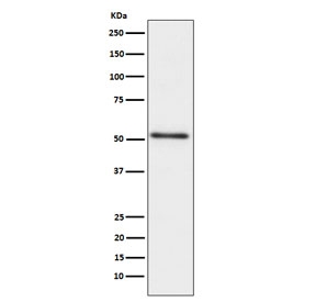 ACPP Antibody western blot analysis of Prostatic acid phosphatase in human prostate cancer lysate. Western blot was performed using human prostate cancer lysate probed with ACPP antibody. A single band is detected at approximately 45-50 kDa, consistent with the predicted molecular weight of Prostatic acid phosphatase (ACP3 / PAP). Detection of this band aligns with the expected expression of PAP in prostate-derived cells and prostate cancer tissue lysates commonly used in prostate biology research.