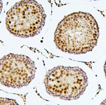 IHC staining of FFPE rat testis with SOX15 antibody. HIER: boil tissue sections in pH6, 10mM citrate buffer, for 20 min and allow to cool before testing.