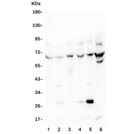 Western blot testing of 1) rat brain, 2) rat liver and mouse 3) brain, 4) lung, 5) liver and 6) NIH3T3 lysate with TDRD3 antibody at 0.5ug/ml. Expected molecular weight: 73-83 kDa.