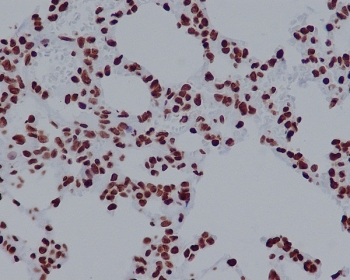 H2AFX Antibody Immunohistochemistry. IHC staining of FFPE rat lung tissue with H2AFX antibody. HIER: boil tissue sections in pH6, 10mM citrate buffer, for 10-20 min and allow to cool before testing.