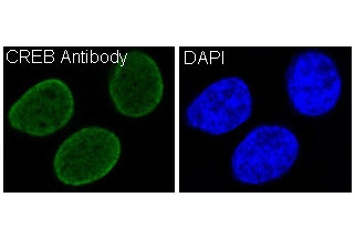 Immunofluorescent staining of FFPE human HeLa cells (green) and DAPI nuclear stain (blue). HIER: boil tissue sections in pH6, 10mM citrate buffer, for 10-20 min and allow to cool before testing.