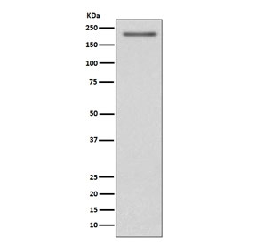 PDGFRA Antibody SH-SY5Y WB. Western blot analysis of human SH-SY5Y cell lysate using PDGFRA Antibody / Platelet-Derived Growth Factor Receptor Alpha Antibody demonstrates a strong immunoreactive band at approximately 180 kDa, consistent with expression of mature PDGFRA protein. PDGFRA is a receptor tyrosine kinase that mediates signaling from platelet-derived growth factors and regulates cellular proliferation, survival, migration, differentiation, and developmental processes. The observed molecular weight is higher than the predicted core protein size due to extensive glycosylation and other post-translational modifications that are characteristic of the mature receptor. The detected band is consistent with endogenous PDGFRA expression in human SH-SY5Y cells. Expected molecular weight: 120-195 kDa.