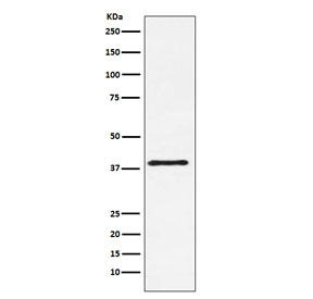 Western blot testing of mouse NIH3T3 cell lysate with CD152 antibody. Predicted molecular weight ~25 kDa but may be observed at higher molecular weights due to glycosylation.