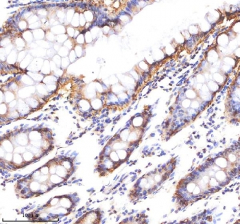 EpCAM Antibody Human Colon IHC. Immunohistochemistry staining of FFPE human colon tissue using EpCAM Antibody demonstrates distinct membranous HRP-DAB brown staining throughout the colonic epithelial lining, including surface epithelial cells and glandular crypt structures. The staining pattern is consistent with expression of Epithelial Cell Adhesion Molecule (EPCAM/CD326), a transmembrane glycoprotein involved in epithelial cell adhesion, maintenance of tissue architecture, and regulation of epithelial differentiation. Strong membrane-associated staining highlights the organized epithelial compartment of the colonic mucosa, while underlying stromal and connective tissue elements remain largely negative. The observed immunoreactivity is consistent with the established expression of EpCAM in normal gastrointestinal epithelium and supports its use as a marker for epithelial cell identification, tissue organization studies, and epithelial lineage characterization. HIER: boil tissue sections in pH 8 EDTA buffer for 20 minutes and allow to cool before testing.