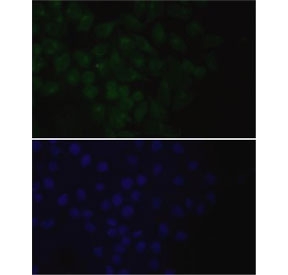 Immunofluorescent staining of FFPE human HeLa cells with EpCAM antibody (green) and DAPI nuclear stain (blue). HIER: steam section in pH6 citrate buffer for 20 min.