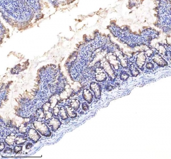 EpCAM Antibody Rat Small Intestine IHC. Immunohistochemistry staining of FFPE rat small intestine tissue using EpCAM Antibody demonstrates membranous HRP-DAB brown staining throughout the intestinal epithelial compartment, including surface epithelial cells and glandular crypt structures. The staining pattern is consistent with expression of Epithelial Cell Adhesion Molecule (EPCAM/CD326), a transmembrane glycoprotein involved in epithelial cell adhesion, maintenance of tissue architecture, and regulation of epithelial homeostasis. Prominent staining along the epithelial lining highlights the organized cellular boundaries of the intestinal mucosa and is characteristic of EPCAM expression in gastrointestinal epithelial tissues. The observed immunoreactivity supports the use of EpCAM as a marker for epithelial cell identification, intestinal epithelial biology, and studies of epithelial differentiation and tissue organization. HIER: boil tissue sections in pH 8 EDTA buffer for 20 minutes and allow to cool before testing.