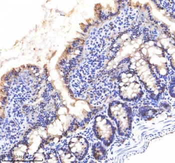 EpCAM Antibody Rat Small Intestine Crypt IHC. Immunohistochemistry staining of FFPE rat small intestine tissue using EpCAM Antibody demonstrates distinct membranous HRP-DAB brown staining within epithelial cells lining the intestinal mucosa, with particularly prominent signal along the luminal surface and crypt-associated glandular structures. The staining pattern is consistent with expression of Epithelial Cell Adhesion Molecule (EPCAM/CD326), a cell surface glycoprotein involved in epithelial cell adhesion, tissue organization, and maintenance of epithelial integrity. Strong membrane-associated staining highlights epithelial cell boundaries and reflects the established localization of EPCAM within gastrointestinal epithelial compartments. The observed immunoreactivity supports the use of EpCAM as a marker for epithelial lineage identification, intestinal epithelial differentiation, and studies of epithelial tissue architecture. HIER: boil tissue sections in pH 8 EDTA buffer for 20 minutes and allow to cool before testing.
