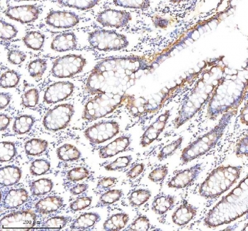 IHC staining of FFPE human colon tissue with EpCAM antibody. HIER: boil tissue sections in pH8 EDTA for 20 min and allow to cool before testing.