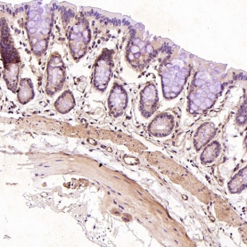 IHC staining of FFPE rat stomach tissue with CD19 antibody. HIER: boil tissue sections in pH6 citrate buffer for 20 min and allow to cool before testing.