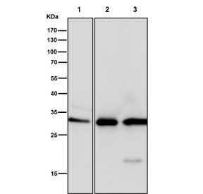 Western blot testing of human 1) HeLa, 2) HepG2 and 3) MCF7 cell lysate with NQO1 antibody. Predicted molecular weight ~30 kDa.