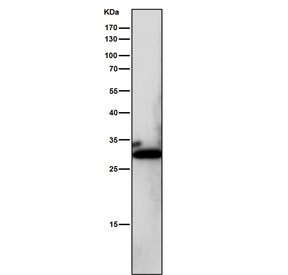 Western blot testing of mouse kidney tissue lysate with NQO1 antibody. Predicted molecular weight ~30 kDa.