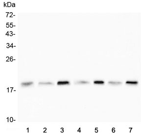 Western blot testing of human 1) HeLa, 2) U-2 OS, 3) HepG2, 4) T-47D, 5) Raji, 6) placenta and 7) A549 lysate with Cofilin 2 antibody. Predicted molecular weight ~19 kDa.