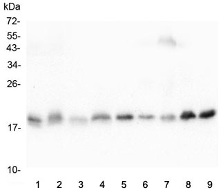 Western blot testing of 1) rat heart, 2) rat liver, 3) rat kidney, 4) rat brain, 5) mouse heart, 6) mouse liver, 7) mouse kidney, 8) mouse brain and 9) mouse NIH3T3 lysate with Cofilin 2 antibody. Predicted molecular weight ~19 kDa.