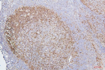 IHC staining of FFPE human tonsil with CDK1 antibody. HIER: boil tissue sections in pH6, 10mM citrate buffer, for 20 min and allow to cool before testing.