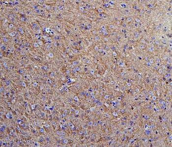 IHC staining of FFPE mouse brain with Hexokinase 1 antibody. HIER: boil tissue sections in pH8 EDTA for 20 min and allow to cool before testing.