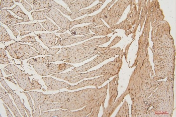 IHC staining of FFPE mouse heart with PPCS antibody. HIER: boil tissue sections in pH6, 10mM citrate buffer, for 20 min and allow to cool before testing.