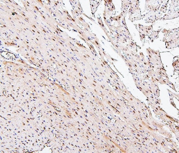 IHC staining of FFPE rat heart with PPCS antibody. HIER: boil tissue sections in pH6, 10mM citrate buffer, for 20 min and allow to cool before testing.