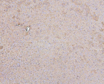 IHC staining of FFPE mouse liver with Hsp60 antibody. HIER: boil tissue sections in pH6, 10mM citrate buffer, for 20 min and allow to cool before testing.