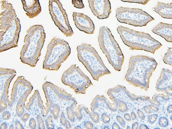 IHC staining of FFPE mouse intestine with ABCB5 antibody. HIER: boil tissue sections in pH6, 10mM citrate buffer, for 20 min and allow to cool before testing.