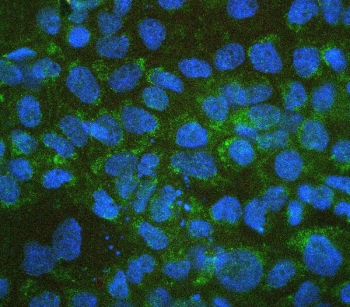 ALDH1A1 Antibody IF. Immunofluorescence analysis of FFPE human A431 cells stained with ALDH1A1 Antibody / Cancer Stem Cell and Retinoic Acid Metabolism Marker (green). Cytoplasmic ALDH1A1 fluorescence is detected throughout the epithelial tumor cell population, consistent with the established localization of Aldehyde dehydrogenase 1 family member A1 / ALDH1A1 in metabolically active carcinoma cells. Nuclear counterstaining was performed with DAPI (blue). HIER: boil tissue sections in 10 mM citrate buffer, pH6, for 20 min followed by cooling before testing.