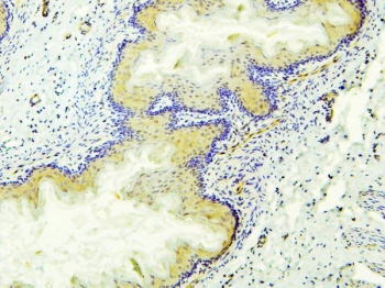 ALDH1A1 Antibody Rat Stomach IHC. Immunohistochemistry analysis of FFPE rat stomach tissue stained with ALDH1A1 Antibody / Cancer Stem Cell and Retinoic Acid Metabolism Marker. Gastric epithelial cells exhibit cytoplasmic HRP-DAB brown staining for Aldehyde dehydrogenase 1 family member A1 / ALDH1A1, consistent with the known role of this aldehyde-metabolizing enzyme in gastrointestinal epithelial metabolism and cellular detoxification pathways. Hematoxylin counterstain highlights nuclei in blue. HIER: boil tissue sections in 10 mM citrate buffer, pH6, for 20 min followed by cooling before testing.
