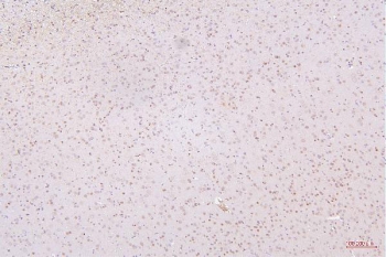 IHC staining of FFPE rat brain with HMGB1 antibody. HIER: boil tissue sections in pH6, 10mM citrate buffer, for 20 min and allow to cool before testing.