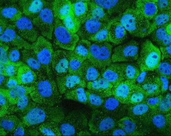 Immunofluorescent staining of FFPE human A431 cells with Hsp105 antibody (green) and DAPI (blue). HIER: boil tissue sections in pH6, 10mM citrate buffer, for 20 min and allow to cool before testing.