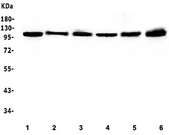 Western blot testing of human 1) Caco-2, 2) K562, 3) A549, 4) HepG2, 5) PANC-1 and 6) SGC-7901 cell lysate with Hsp105 antibody. Expected molecular weight: 105-110 kDa.