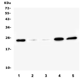 Western blot testing of 1) rat testis, 2) mouse lung, 3) mouse kidney, 4) mouse testis and 5) mouse Neuro-2a lysate with Ran antibody. Predicted molecular weight ~24 kDa.