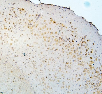 IHC staining of FFPE mouse brain with DCC antibody. HIER: boil tissue sections in pH6, 10mM citrate buffer, for 20 min and allow to cool before testing.
