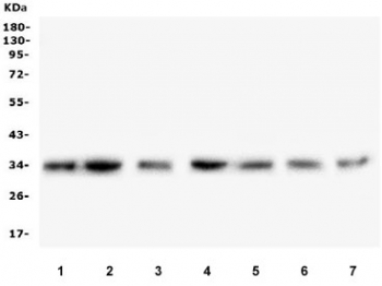Western blot testing of human 1) HEK293, 2) HepG2, 3) placenta, 4) Caco-2, 5) A549, 6) PANC-1 and 7) SW579 lysate with COPE antibody. Predicted molecular weight ~34 kDa.
