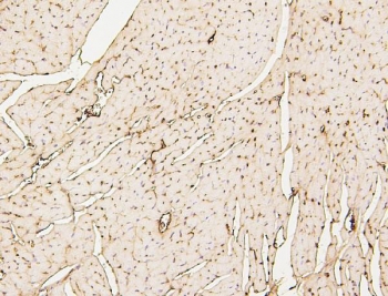 IHC staining of FFPE mouse heart with SDHB antibody. HIER: boil tissue sections in pH6, 10mM citrate buffer, for 20 min and allow to cool before testing.
